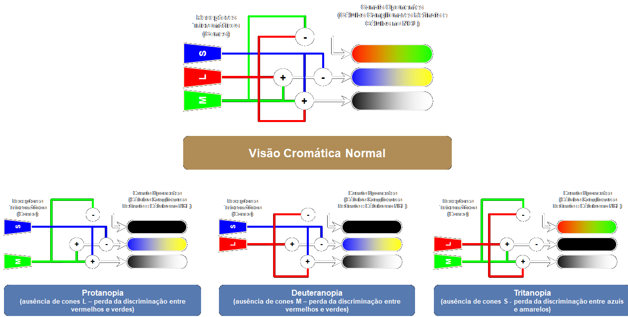 Circuitos neuronais simplificados subjacentes à visão cromática normal e dicromacias